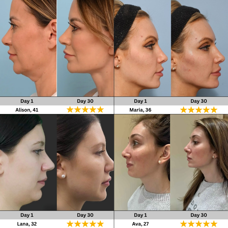 TheGlowra™ Facial Sculpting Massager